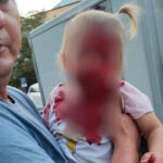 Родственница олигарха не понесет наказания за рассечение головы ребенка в Крыму – Газета.Ru | Новости